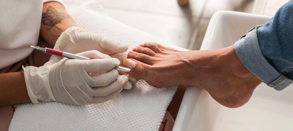Professional chiropodist providing nail and skin treatment in Blackburn clinic
