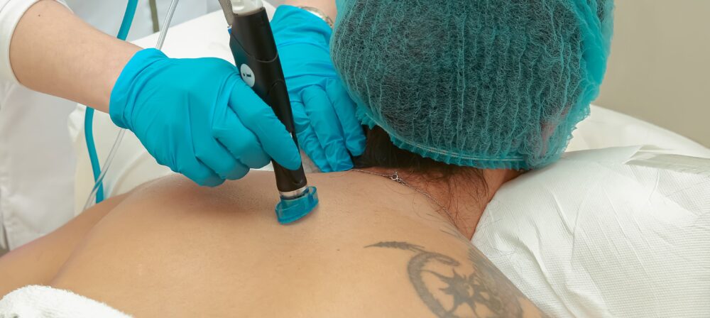 verruca removal Blackburn